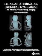 Fetal and Perinatal Skeletal Dysplasias: An Atlas of Multimodality Imaging 2nd Edition | دیسپلازی اسکلتی جنینی و پری ناتال: اطلس تصویربرداری چندوجهی ویرایش دوم