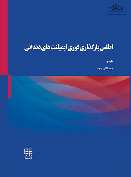 اطلس بارگذاری فوری ایمپلنت های دندانی