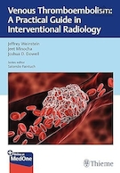 Venous Thromboembolism: A Practical Guide in Interventional Radiology | ترومبوآمبولی وریدی: راهنمای عملی در رادیولوژی مداخله ای