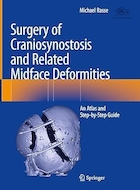 Surgery of Craniosynostosis and Related Midface Deformities: An Atlas and Step-by-Step Guide | جراحی کرانیوسینوستوز و ناهنجاری های مربوط به میانی صورت: راهنمای اطلس و گام به گام