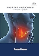Head and Neck Cancer: Clinical Aspects | سرطان سر و گردن: جنبه های بالینی