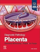 Diagnostic Pathology: Placenta 3rd Edition | آسیب شناسی تشخیصی: جفت نسخه سوم