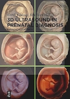 3D Ultrasound in Prenatal Diagnosis: A Practical Approach 2nd edition | سونوگرافی سه بعدی در تشخیص پیش از تولد: یک رویکرد عملی ویرایش دوم