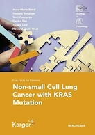 Non-small Cell Lung Cancer With Kras Mutation | سرطان ریه سلولی غیر کوچک با جهش کراس