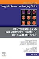 Demyelinating and Inflammatory Lesions of the Brain and Spine, An Issue of Magnetic Resonance Imaging Clinics of North America | ضایعات دمیلینه کننده و التهابی مغز و ستون فقرات، شماره کلینیک های تصویربرداری تشدید مغناطیسی آمریکای شمالی