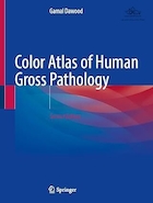 Color Atlas of Human Gross and Microscopic Pathology Second Edition | اطلس رنگی آسیب شناسی میکروسکوپی و کلی انسان، ویرایش دوم