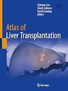 Atlas of Liver Transplantation | اطلس پیوند کبد