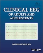 Clinical EEG of Adults and Adolescents 1st Edition | نوار مغزی بالینی بزرگسالان و نوجوانان، ویرایش اول