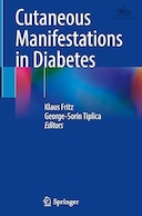 Cutaneous Manifestations in Diabetes | تظاهرات پوستی در دیابت