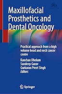 Maxillofacial Prosthetics and Dental Oncology: Practical approach from a high volume head and neck cancer centre | پروتزهای فک و صورت و انکولوژی دندان: رویکرد عملی از یک مرکز سرطان سر و گردن با حجم بالا