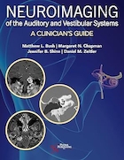 Neuroimaging of the Auditory and Vestibular Systems: A Clinician’s Guide 1st Edition | تصویربرداری عصبی از سیستم های شنوایی و دهلیزی: راهنمای پزشک، ویرایش اول