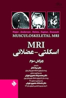 MRI اسکلتی - عضلانی