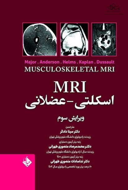MRI اسکلتی - عضلانی