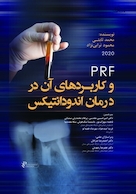 PRF و کاربردهای آن در درمان اندودانتیکس