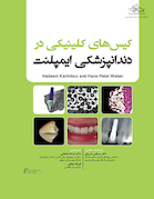 کیس های کلینیکی در دندانپزشکی ایمپلنت