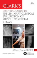 Clark’s Essential Guide to Preliminary Clinical Evaluation of Musculoskeletal X-rays: Evaluating and Commenting on Images | راهنمای ضروری کلارک برای ارزیابی بالینی اولیه عکس های رادیولوژی اسکلتی-عضلانی: ارزیابی و اظهار نظر در مورد تصاویر