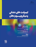 ایمپلنت های دندانی و میکروبیوم دهان