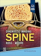 Diagnostic Imaging: Spine 5th Edition | تصویربرداری تشخیصی: ستون فقرات، ویرایش پنجم