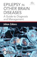 Epilepsy in Other Brain Diseases: A Guide to Diagnosis and Management 1st Edition | صرع در سایر بیماری های مغزی: راهنمای تشخیص و مدیریت، ویرایش اول