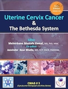Uterine Cervix Cancer The Bethesda System | سرطان دهانه رحم سیستم بتسدا