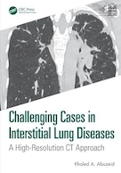Challenging Cases in Interstitial Lung Diseases: A High-resolution Ct Approach | موارد چالش برانگیز در بیماری های بینابینی ریه: رویکرد سی تی اسکن با وضوح بالا