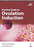 Practical Guide to Ovulation Induction | راهنمای عملی برای تحریک تخمک گذاری