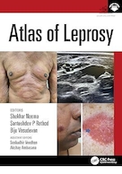 Atlas of Leprosy 1st Edition | اطلس جذام، ویرایش اول