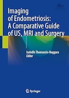 Imaging of Endometriosis: A Comparative Guide of US, MRI and Surgery | تصویربرداری از آندومتریوز: راهنمای مقایسه ای سونوگرافی، ام آر آی و جراحی