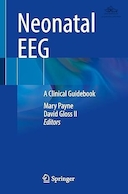 Neonatal EEG: A Clinical Guidebook | EEG نوزاد: یک راهنمای بالینی