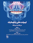 ایمپلنت های زایگوماتیک - مرحله به مرحله