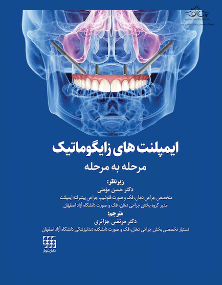 ایمپلنت های زایگوماتیک مرحله به مرحله