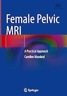 Female Pelvic MRI: A Practical Approach | ام آر آی لگن زنان: یک رویکرد عملی