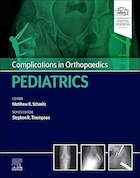 Complications in Orthopaedics: Pediatrics 1st Edition | عوارض در ارتوپدی: اطفال، ویرایش اول