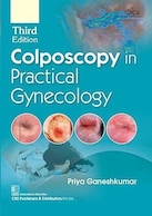 Colposcopy In Practical Gynecology | کولپوسکوپی در زنان و زایمان عملی