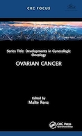 Ovarian Cancer | سرطان تخمدان
