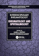 Interdisciplinary Rheumatology: Rheumatology and Ophthalmology | روماتولوژی میان رشته ای: روماتولوژی و چشم پزشکی