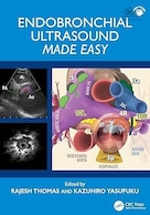 Endobronchial Ultrasound Made Easy: Made Easy 1st Edition | سونوگرافی اندوبرونشی به راحتی انجام می شود: ویرایش اول به راحتی انجام می شود