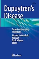 Dupuytren's Disease: Current and Emerging Techniques | بیماری دوپویترن: تکنیک های فعلی و نوظهور