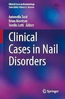 Clinical Cases in Nail Disorders | موارد بالینی در اختلالات ناخن