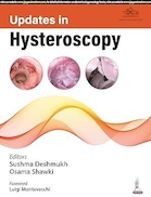 UPDATES IN HYSTEROSCOPY | تازه های هیستروسکوپی