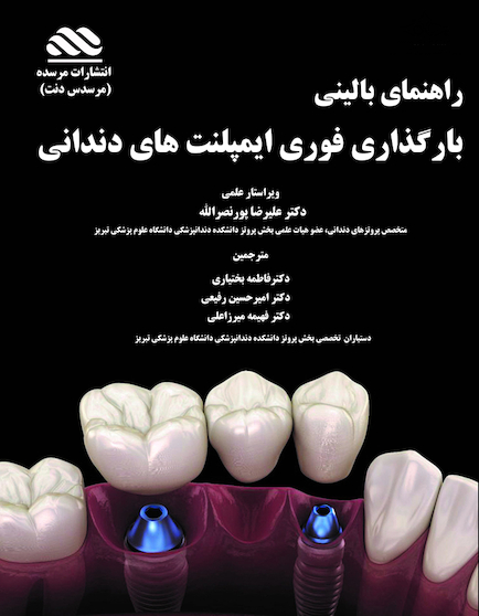 راهنمای بالینی بارگذاری فوری ایمپلنت های دندانی