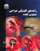 راهنمای کلینیکی جراحی سینوس لیفت