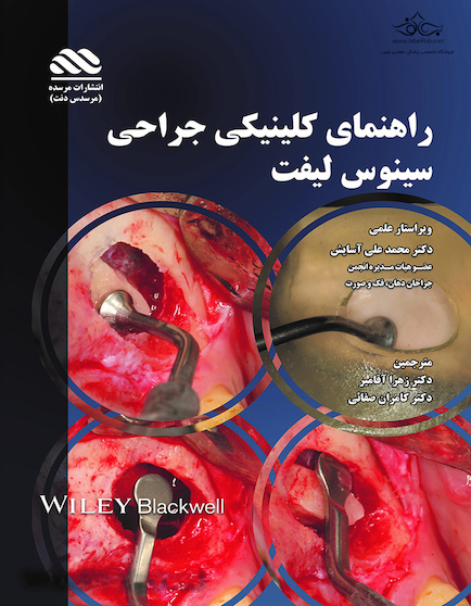 راهنمای کلینیکی جراحی سینوس لیفت