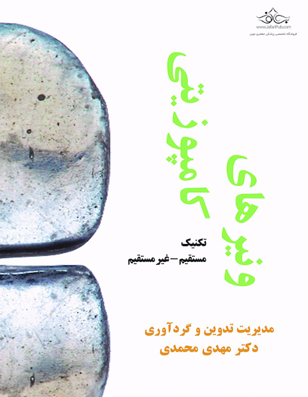 ونیرهای کامپوزیتی