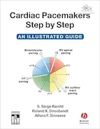 Cardiac Pacemakers Step-by-Step: An Illustrated Guide | راهنمای گام به گام ضربان سازهای قلبی: یک راهنمای مصور