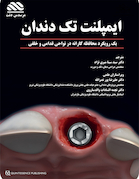ایمپلنت تک دندان