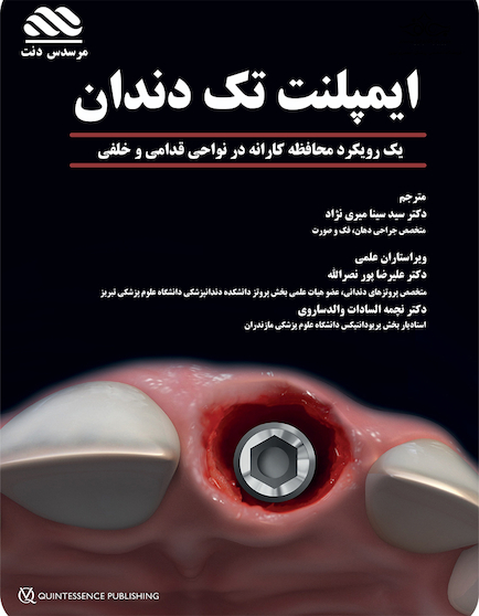 ایمپلنت تک دندان