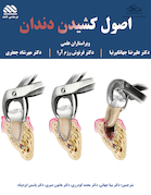 اصول کشیدن دندان