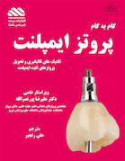 گام به گام پروتزهای ایمپلنت دندان