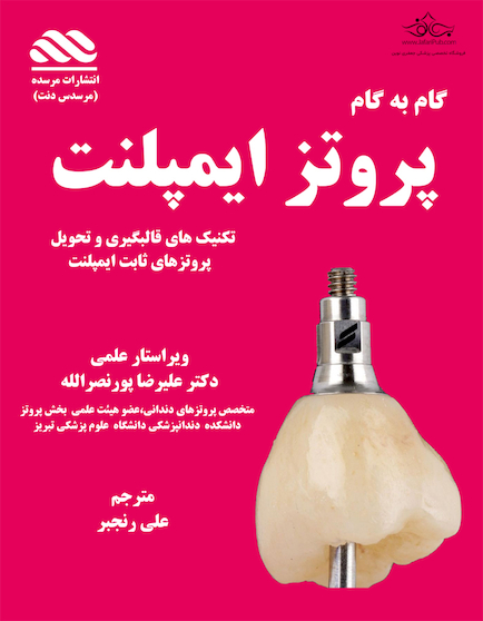 گام به گام پروتزهای ایمپلنت دندان